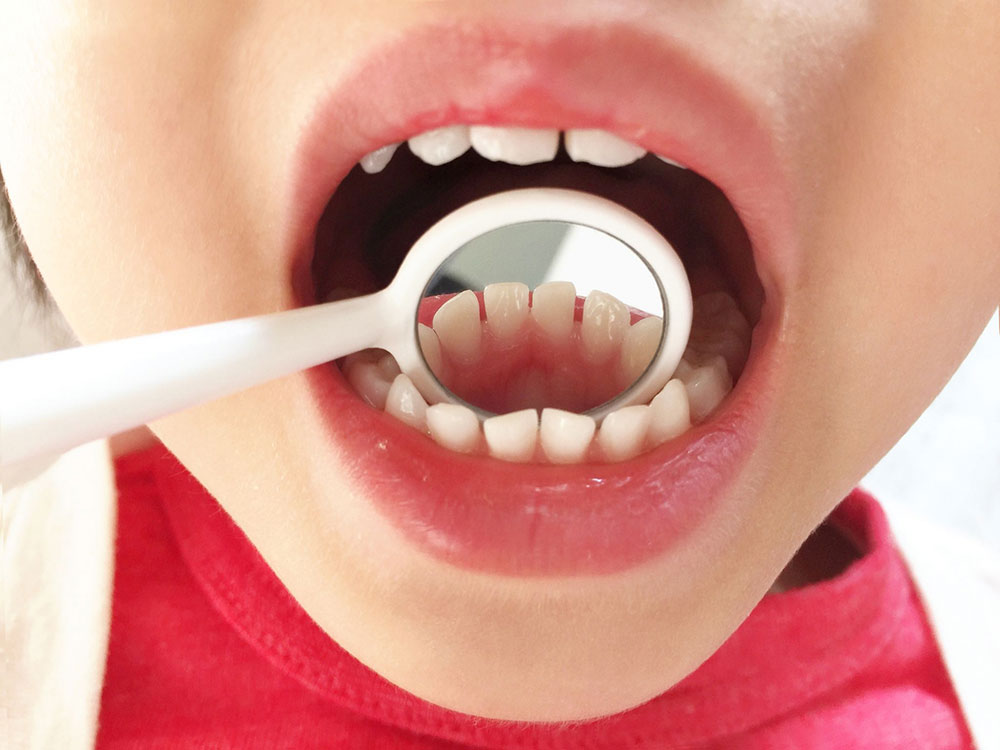 お子さまのむし歯・歯肉炎のリスクが高い理由